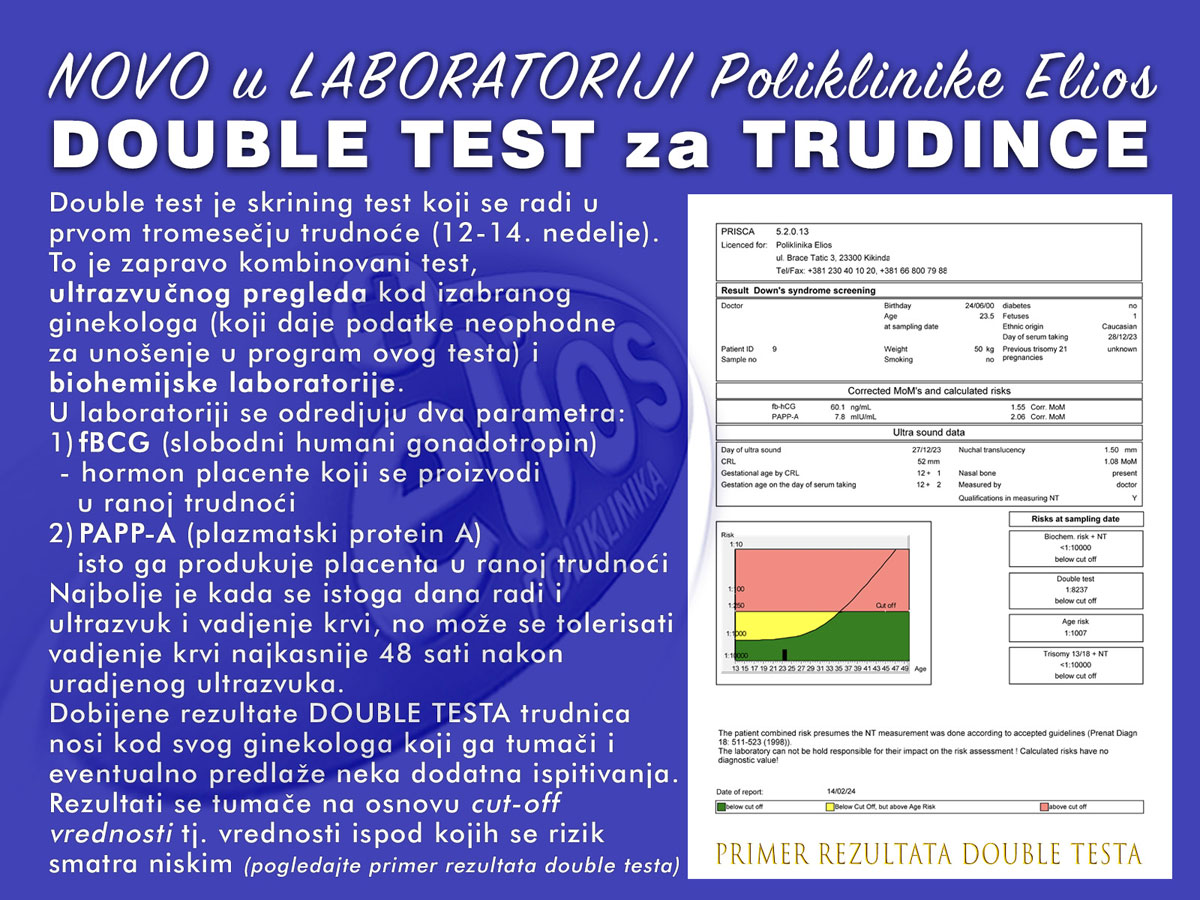 double-test-objava.jpg